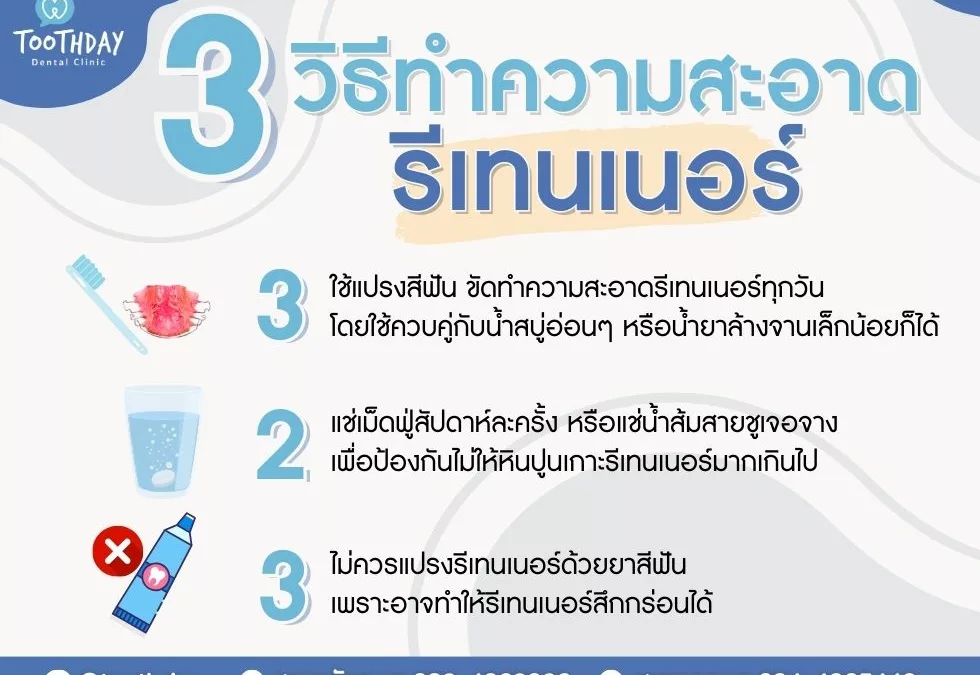 วิธีทำความสะอาดรีเทนเนอร์