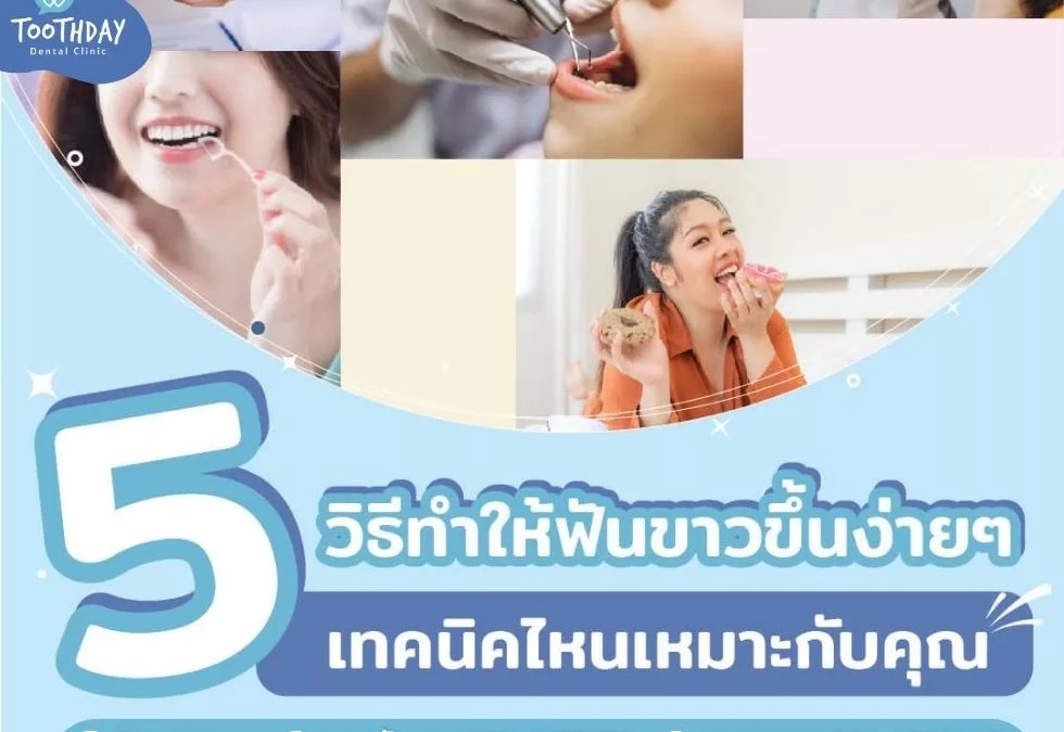 อยากฟันขาวต้องรู้ 5 วิธีฟันขาวง่ายๆ แบบไหนเหมาะกับคุณ