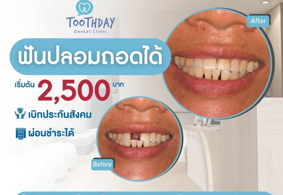 ฟันปลอมถอดได้